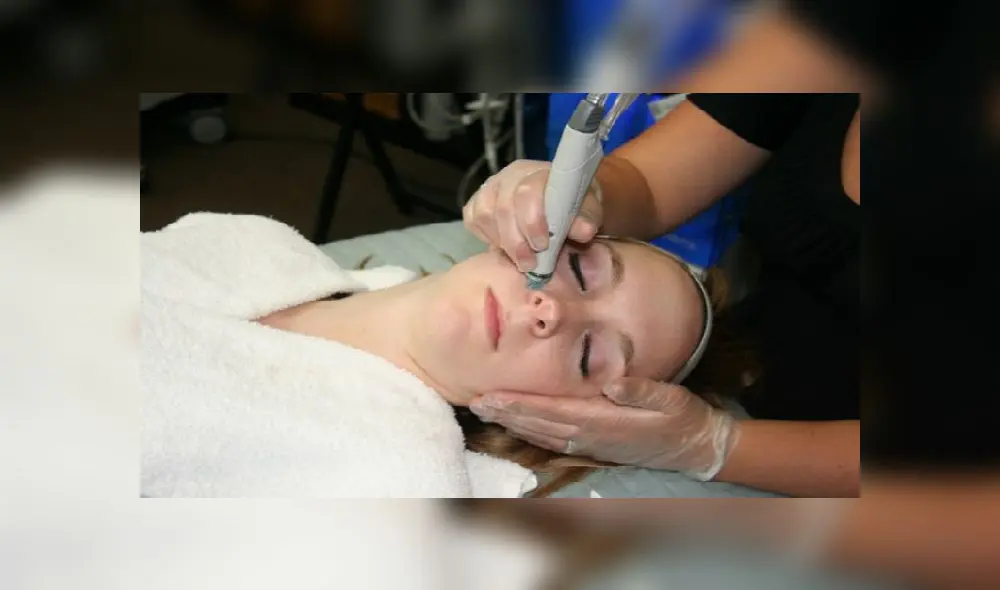 Tratamiento de la piel - cara. Foto: Internet