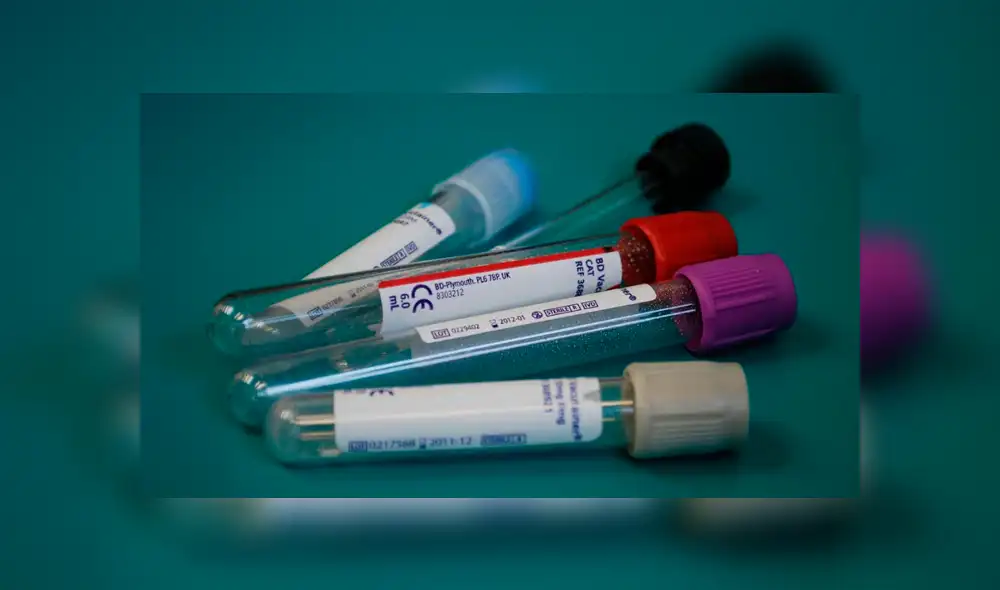 Número de investigaciones clínicas en el Perú se redujo en 68% en la última década Número de investigaciones clínicas en el Perú se redujo en 68% en la última década