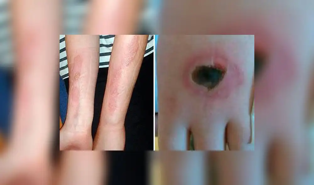 Las graves consecuencias del desafío de la sal y el hielo alerta a Reino Unido 