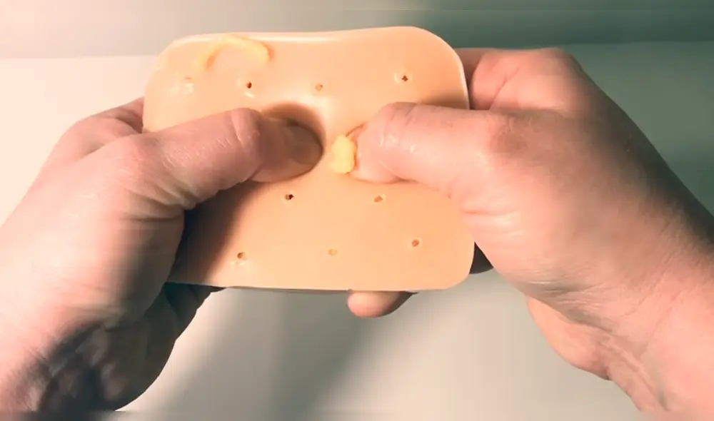 YouTube Viral: Lanzan juguete antiestrés para reventar granos llenos de pus [VIDEO]
