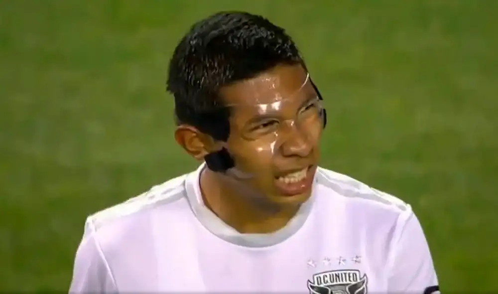 Edison Flores sufrió una lesión facial a fines de agosto en un partido de la MLS. Foto: Captura de ESPN