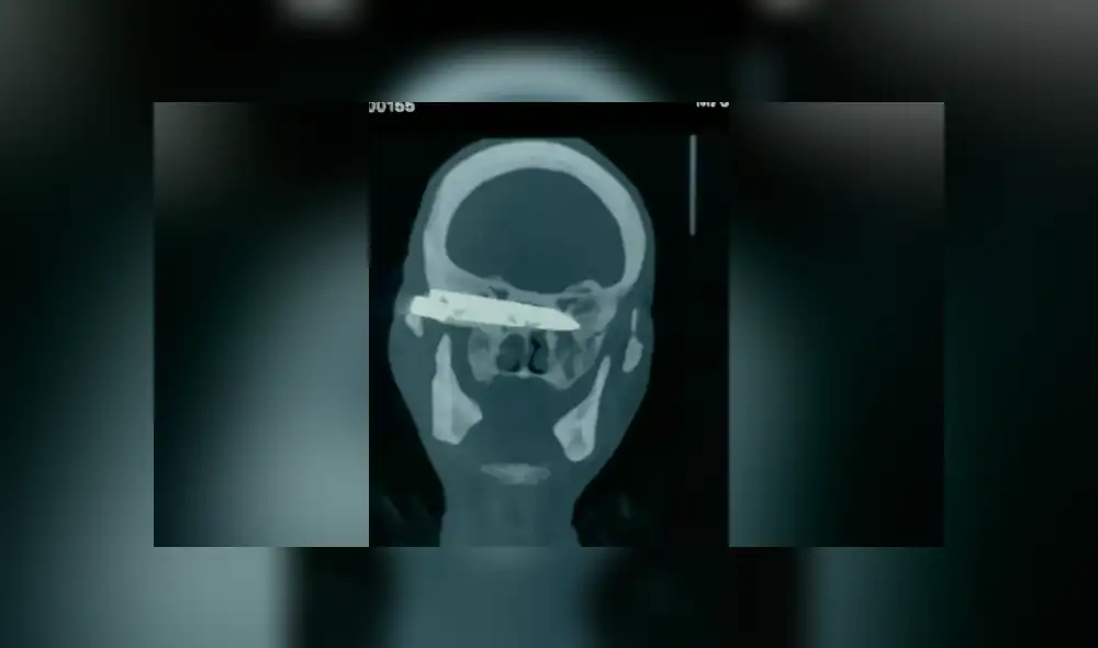 Duorijie sobrevivió al violento asalto, pero acabó con un cuchillo clavado en la cabeza. (Foto: Difusión)