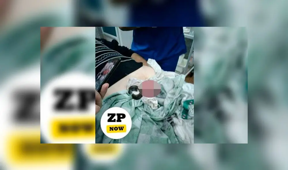 Colocó una tuerca en el miembro viril de su esposo como ‘castigo’ al enterarse que le fue infiel [VIDEO]