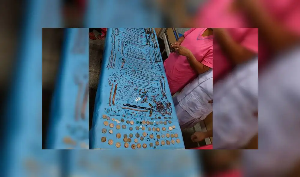 Aproximadamente 1.6 kilos de joyería la que se encontró en el estómago de la mujer de 22 años. Fotos: Daily Mail Aproximadamente 1.6 kilos de joyería la que se encontró en el estómago de la mujer de 22 años. Fotos: Daily Mail