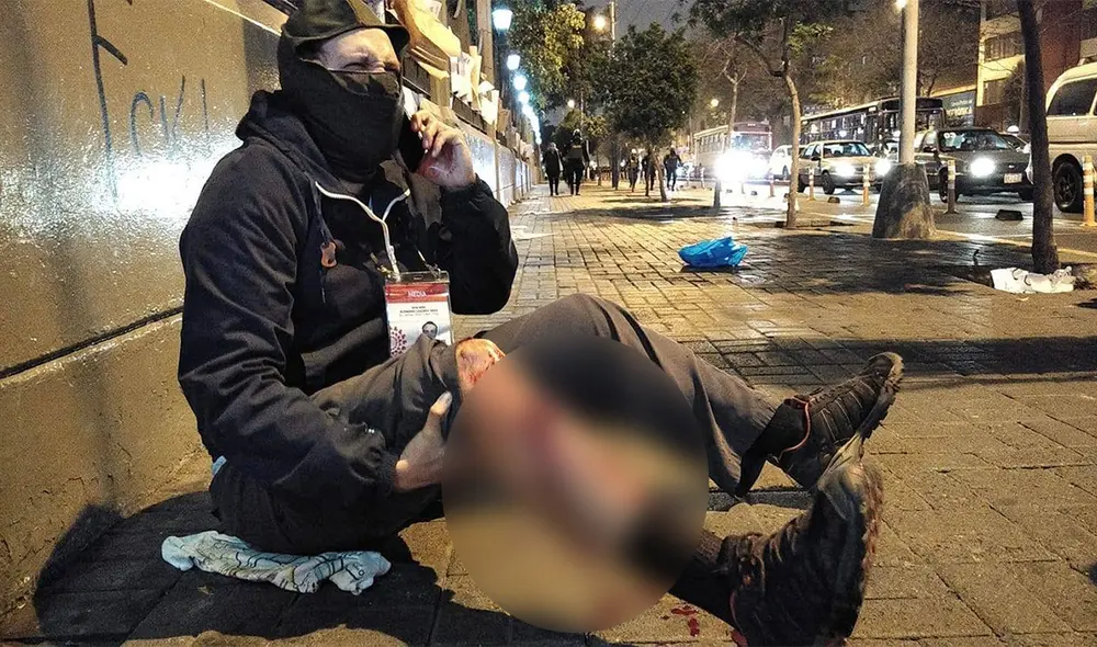 El periodista Alonso Valbuena habría recibido el impacto de manera directa. Foto: Twitter @Meleyza1