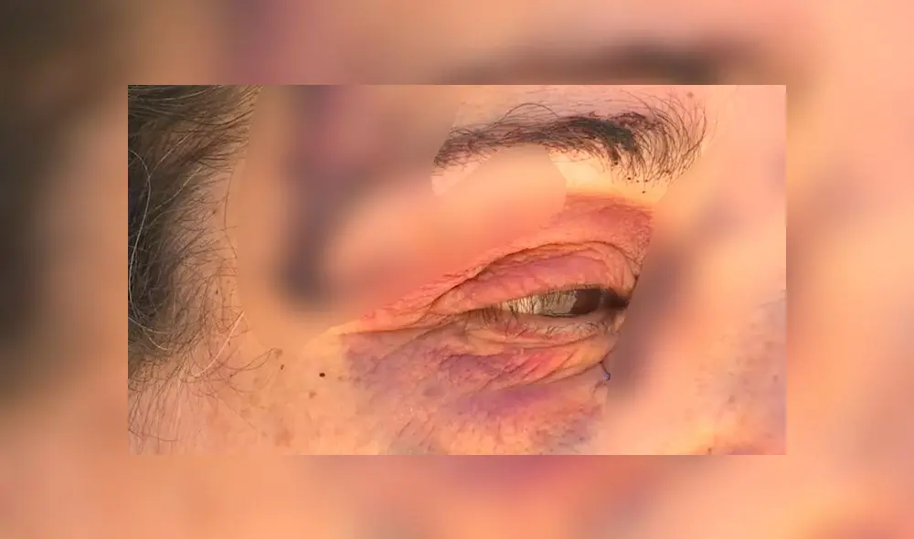 Mujer estuvo a punto de perder la vista tras ser atacada brutalmente por un canguro [VIDEO]