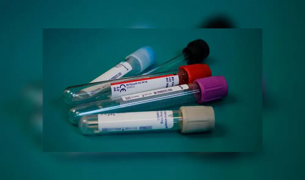 Logran curar del VIH al tercer paciente en el mundo gracias a trasplante