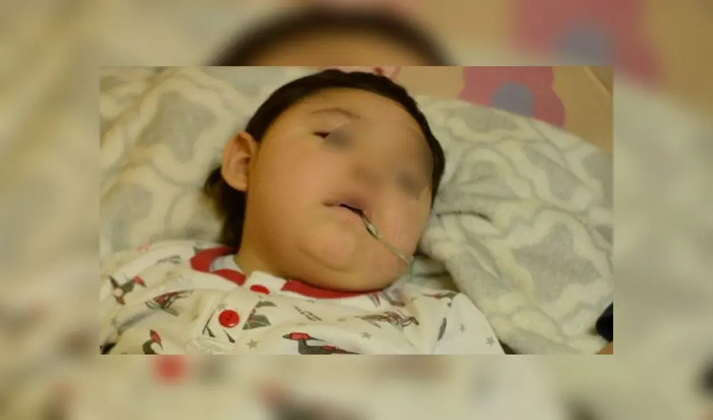 Gabrielito está próximo a cumplir los tres años. En este tiempo ha demostrado ser un niño con mucha fortaleza. (Foto: Facebook Juntos por Gabrielito) Gabrielito está próximo a cumplir los tres años. En este tiempo ha demostrado ser un niño con mucha fortaleza. (Foto: Facebook Juntos por Gabrielito)