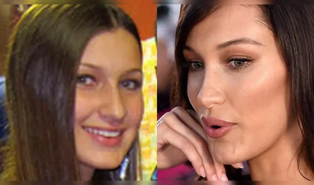 Antes y después de Bella Hadid: La transformación de “la mujer más bella" [FOTOS]