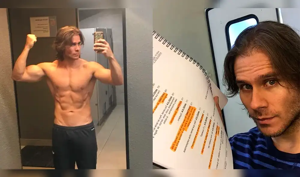 Miguel Arce remece las redes al aparecer con el rostro “desfigurado”