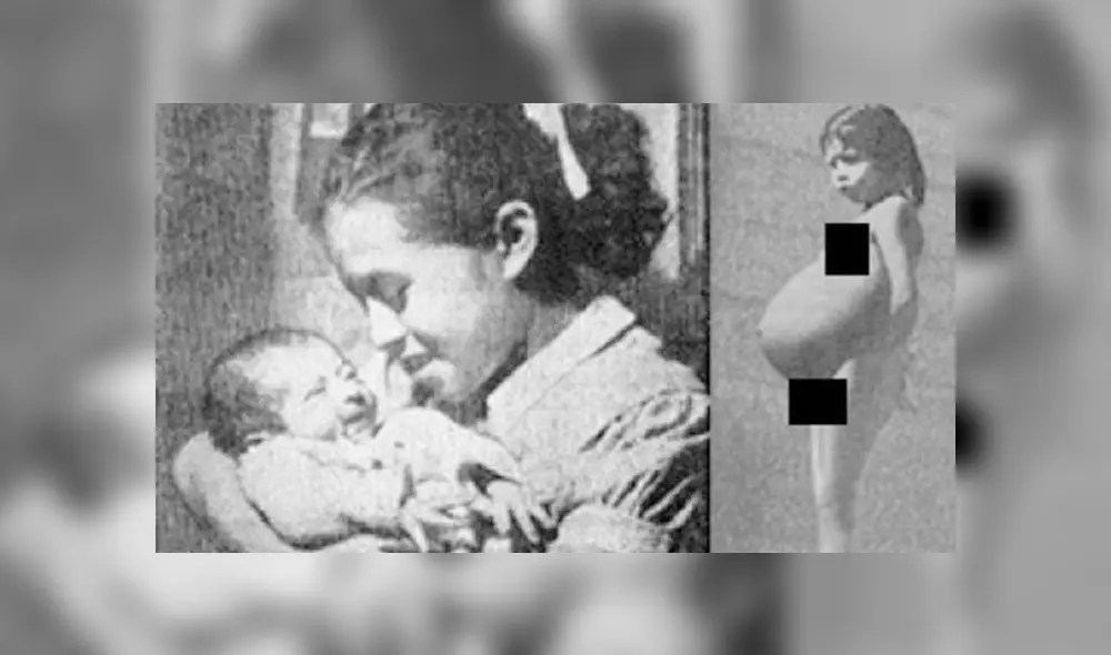 Lina Medina, la niña que a los 5 años se convirtió en mamá [CRÓNICA]