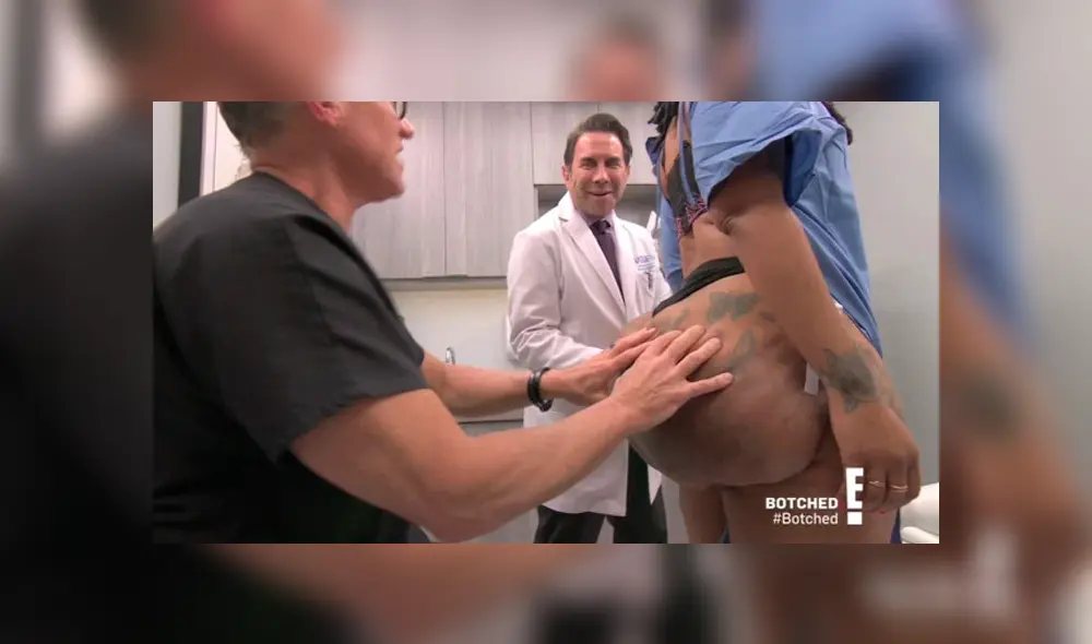 Mujer necesita que le amputen sus nalgas después de aumentarse con inyecciones ilegales [VIDEO]