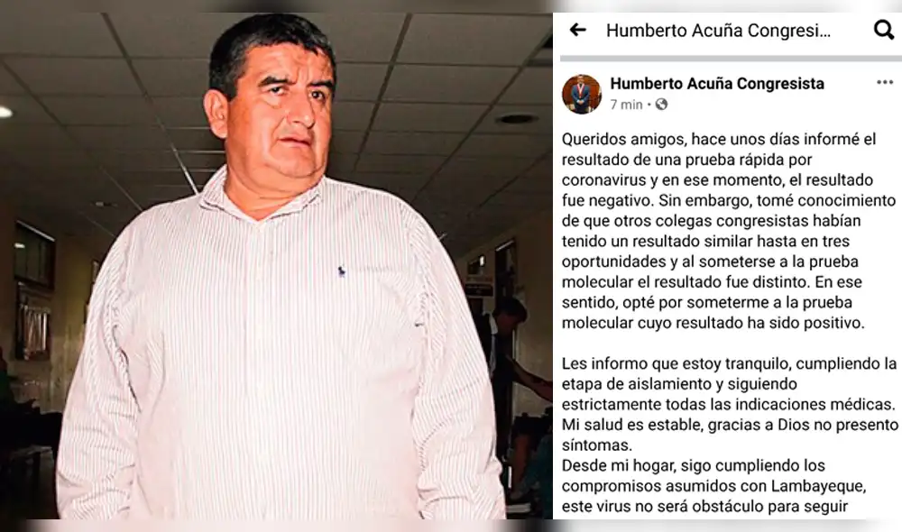 Congresista Acuña dio positivo para coronavirus. Congresista Acuña dio positivo para coronavirus.
