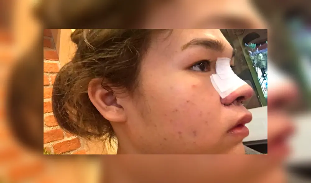 Vía Facebook: asiática se harta de ser el 'patito feo' y cambia su aspecto con rigurosas cirugías [FOTOS]