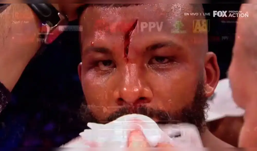 Pacquiao vs Broner: El espeluznante corte en la frente de Badou Jack [FOTO]