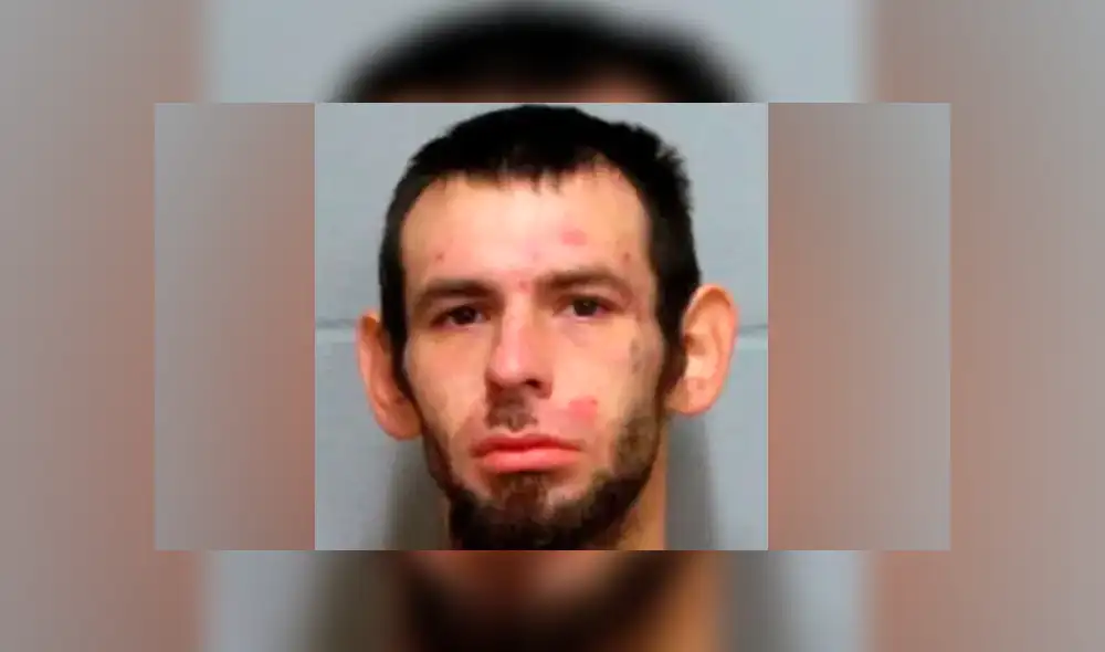 Hombre lanza ácido al rostro de su expareja durante discusión e intenta darse a la fuga