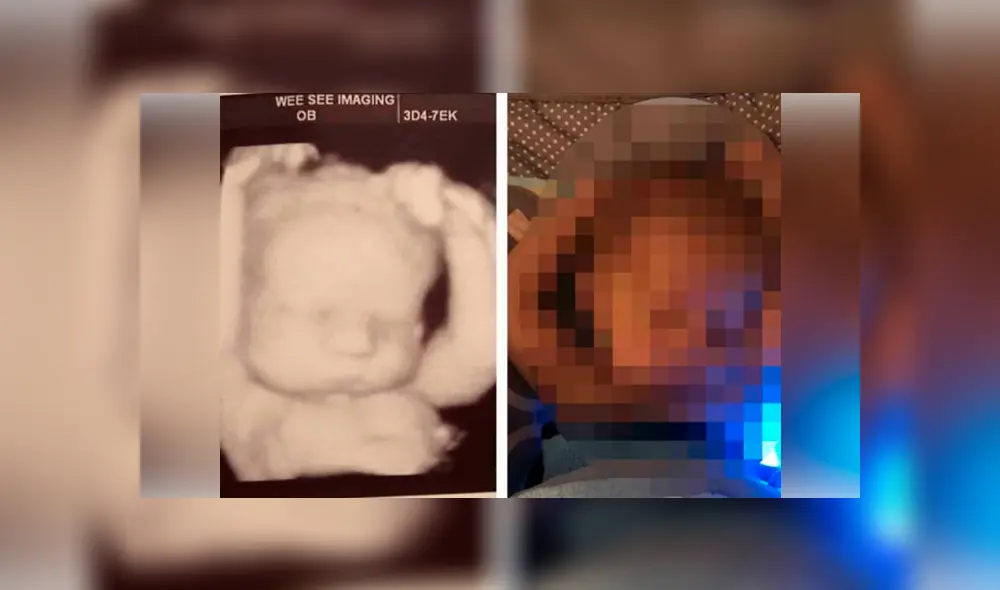 Bebé durmiendo como lo hacía en el útero de su madre enternece a miles [FOTOS]