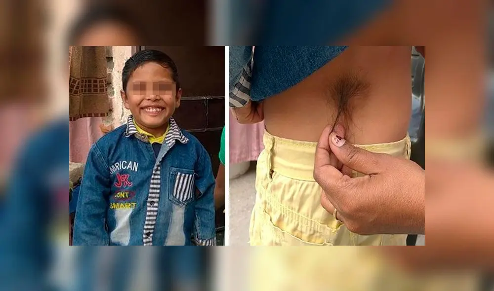 Niño que nació con ‘cola’ es adorado como un ‘Dios mono’, pero sus padres lo esconden [FOTOS]