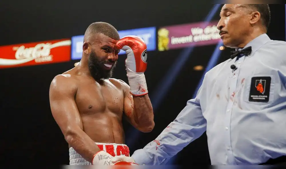 Pacquiao vs Broner: El espeluznante corte en la frente de Badou Jack [FOTO]