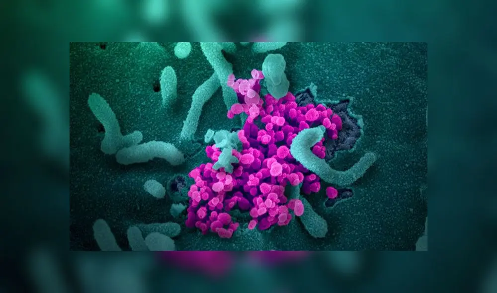 Miles de partículas del coronavirus saliendo de las células humanas. Imagen: Nature.