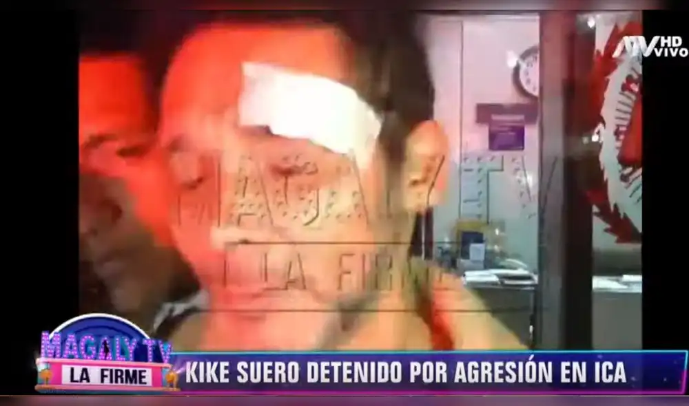 Kike Suero pelea con detenido en comisaría y termina con la ceja rota Kike Suero pelea con detenido en comisaría y termina con la ceja rota