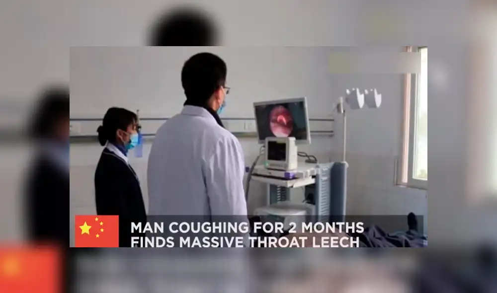 Fue al hospital para tratarse una tos y descubren dos parásitos alojados en su garganta