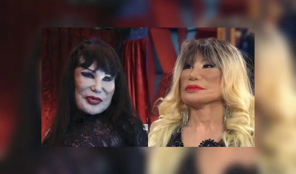Lyn May, la emblemática vedette, vuelve a causar polémica debido a su imagen tras someterse a una nueva cirugía en el rostro. Lyn May, la emblemática vedette, vuelve a causar polémica debido a su imagen tras someterse a una nueva cirugía en el rostro.