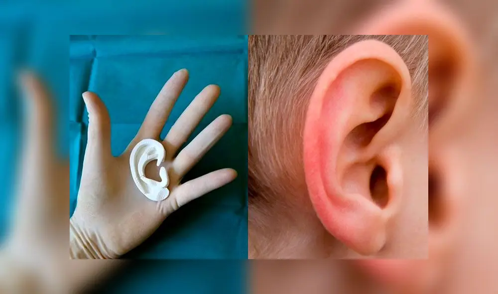 Médicos italianos logran darle sus primeras orejas a un niño que sufre microtia. Fotos Notiziedi / referencial.