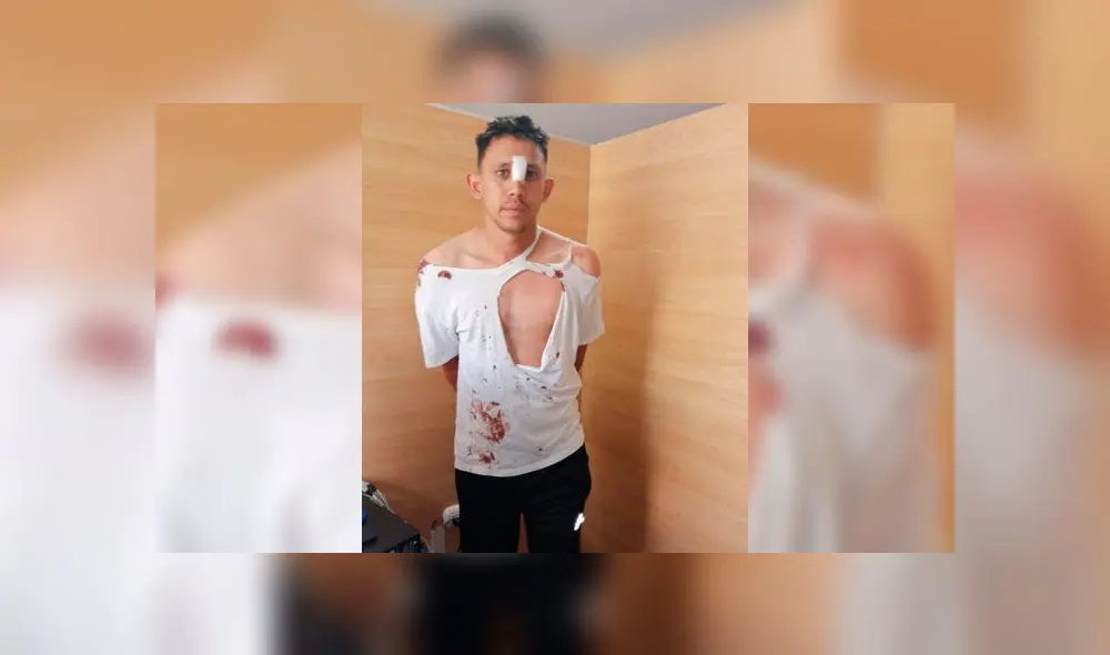 Sujeto intentó quemar a mujer después de que ella se negó a ser su pareja. Créditos: Difusión.