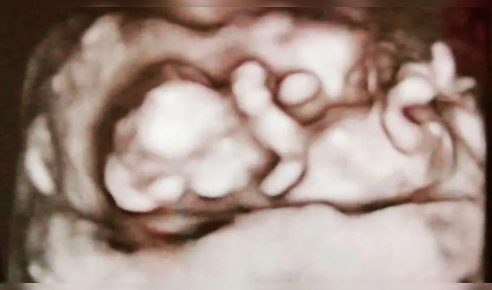 Daniela Cilloniz revela segundo embarazo