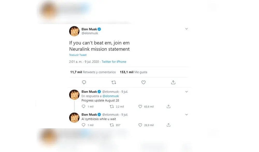 Elon Musk y su proyecto Neuralink. Foto: captura Twitter Elon Musk.