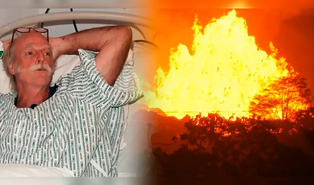 Bomba de lava del volcán Kilauea rompió y quemó pierna de hombre [VIDEO]