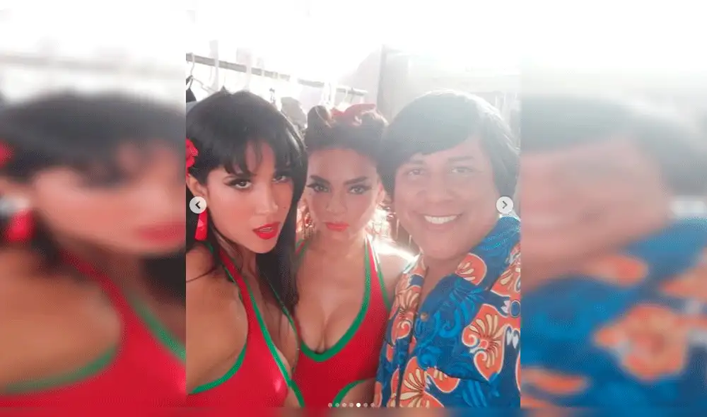 Así luce Melissa Paredes tras sufrir accidente en el rostro  [VIDEO]