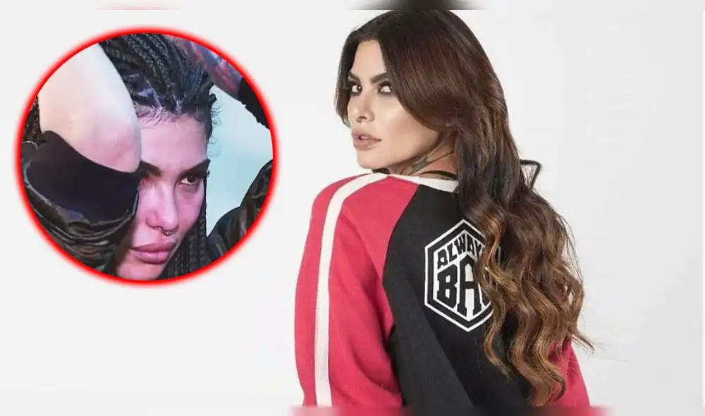 Angie Jibaja aparece con moretón en el brazo y niega que haya recaído en las drogas [VIDEO]