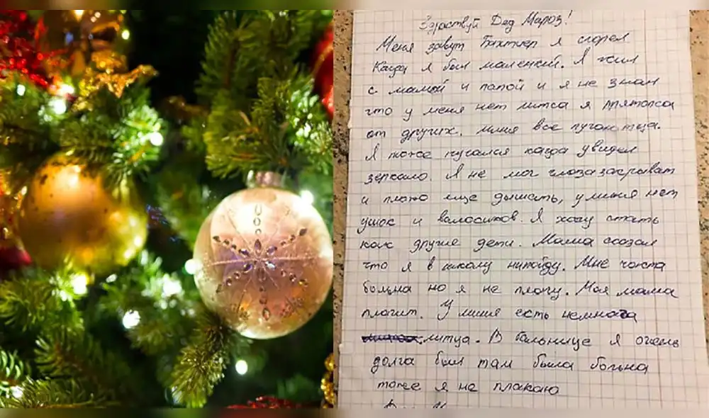 Carta de Navidad: niño que sobrevivió incendio y quedó desfigurado pide nuevo rostro a Papa Noel