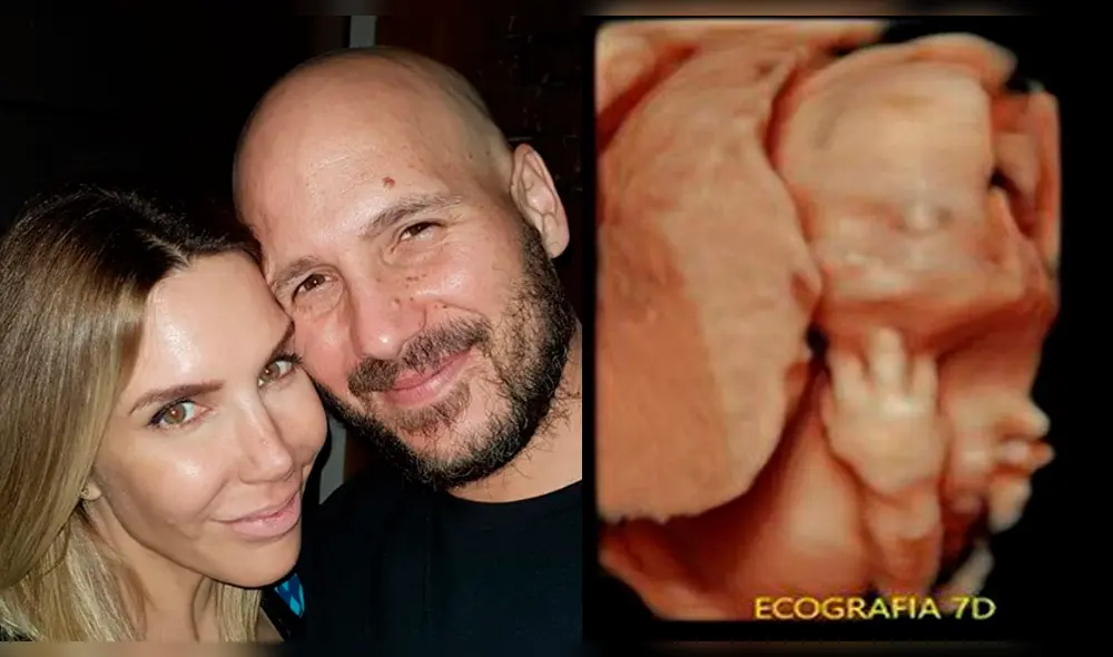 Milovan Radovic revela el embarazo de Juliana Oxenford.