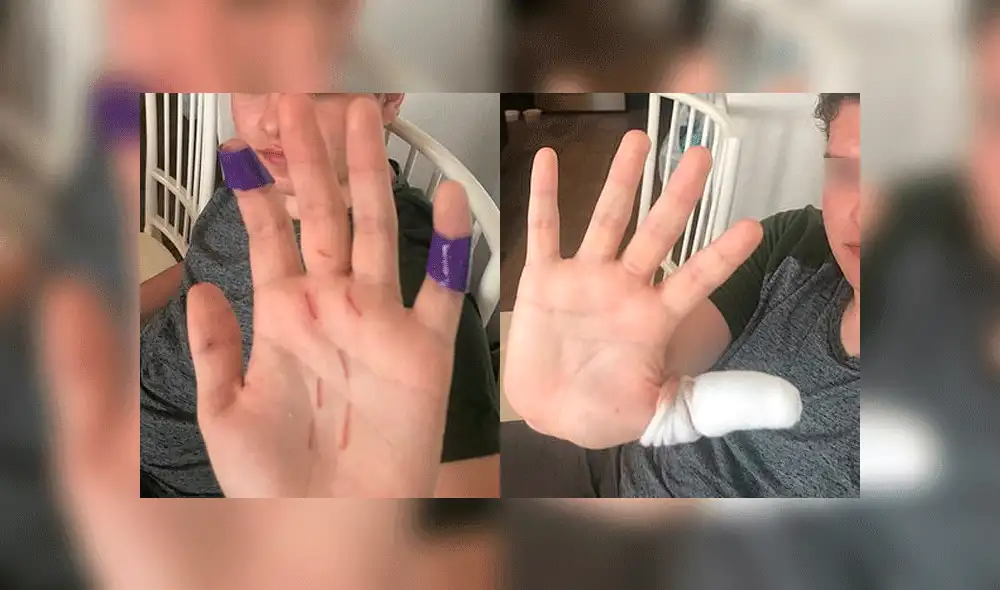 El muchacho quedó con heridas en las manos tras el ataque. Foto: Tim Arthur.