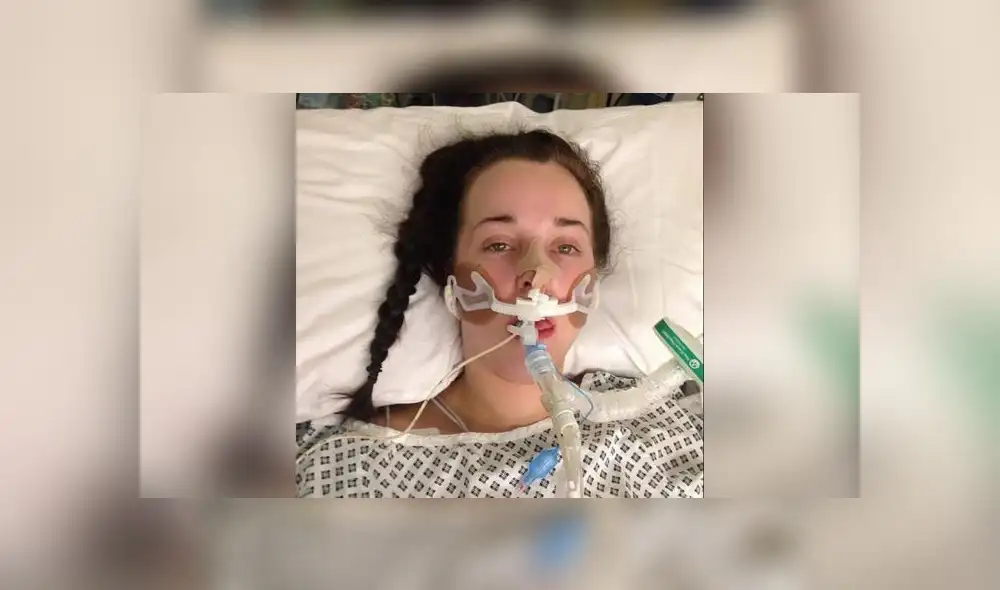 La joven necesitó de tres meses para recuperarse por completo. Foto: SWNS