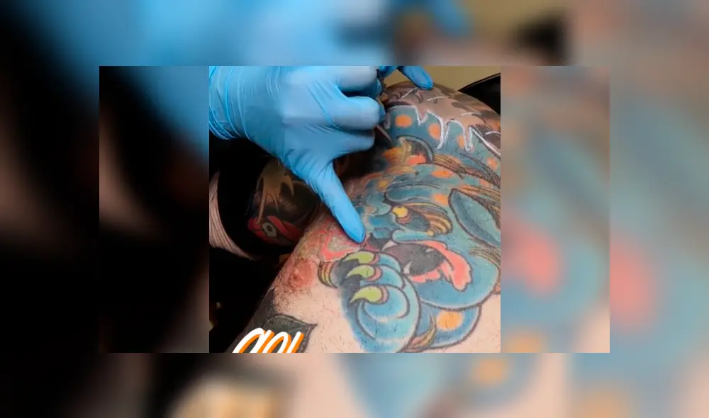 Facebook viral: joven intenta quitarse tatuaje del brazo, sin imaginar el terrible resultado que tendría