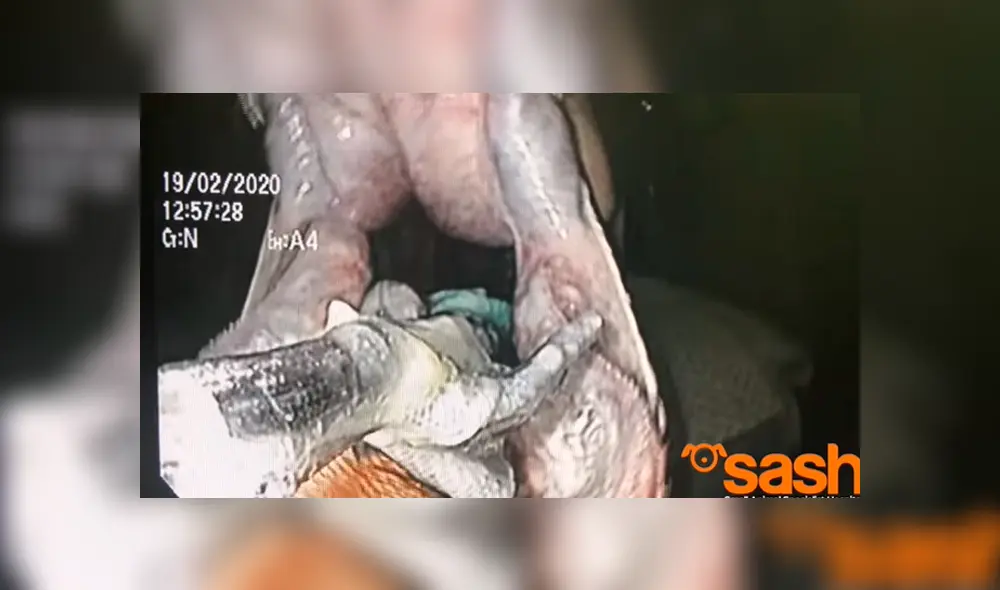 Desliza las fotografías para ver el increíble rescate que se hizo de esta enorme pitón que se tragó una toalla de playa. Foto: captura/SASH Desliza las fotografías para ver el increíble rescate que se hizo de esta enorme pitón que se tragó una toalla de playa. Foto: captura/SASH