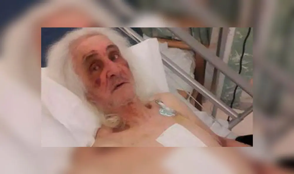 Anciano sufre brutal golpiza a martillazos por parte de ladrones Anciano sufre brutal golpiza a martillazos por parte de ladrones