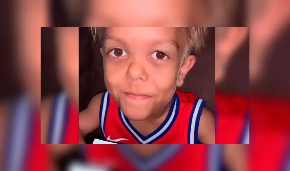 Niño que fue víctima de bullying por enanismo muestra su verdadera edad tras acusaciones [VIDEO]