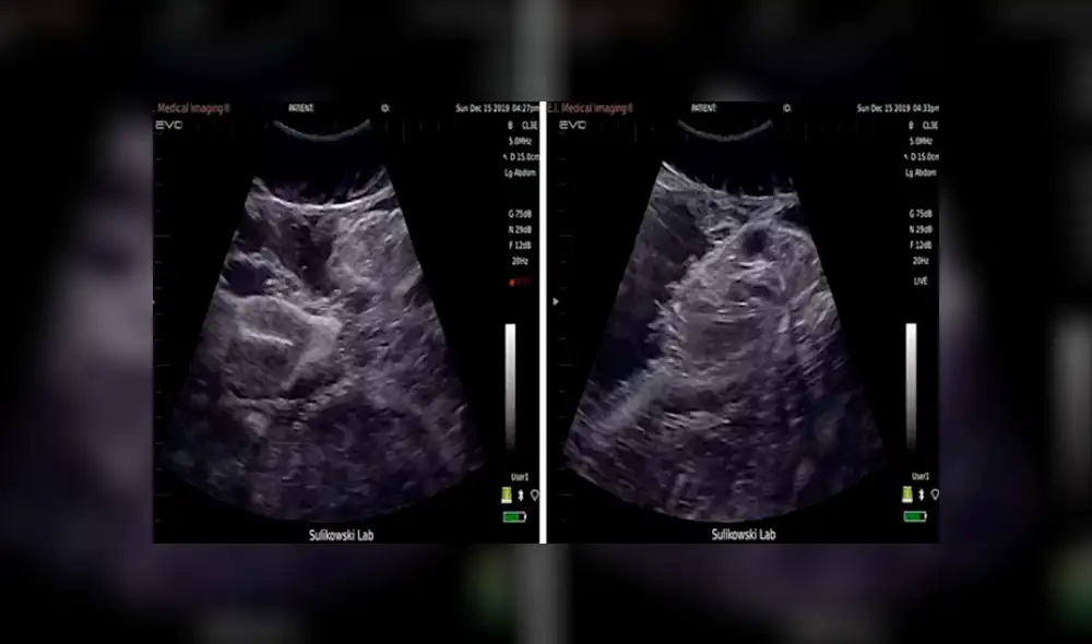 Video es viral en Facebook. Impactantes imágenes muestran el ultrasonido de un tiburón tigre retorciéndose en el útero de su madre Video es viral en Facebook. Impactantes imágenes muestran el ultrasonido de un tiburón tigre retorciéndose en el útero de su madre