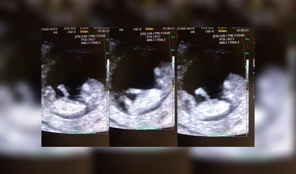 Facebook viral: bebé de 12 semanas juega a la ‘resbaladilla’ en el vientre de su madre y todo queda registrado Facebook viral: bebé de 12 semanas juega a la ‘resbaladilla’ en el vientre de su madre y todo queda registrado