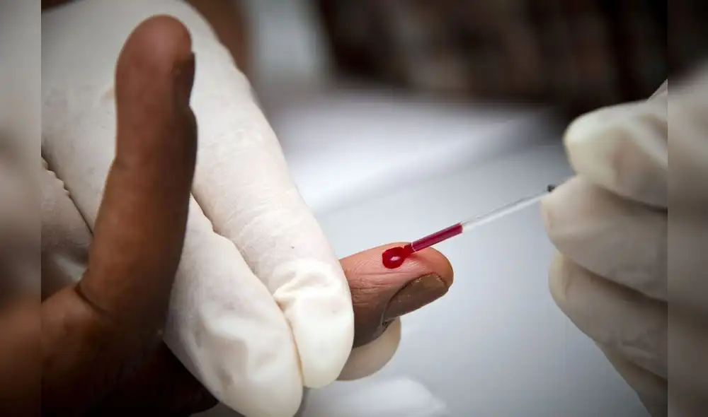 El Día Mundial de la Lucha contra el SIDA se conmemora desde hace 31 años a nivel mundial. Foto: Difusión.