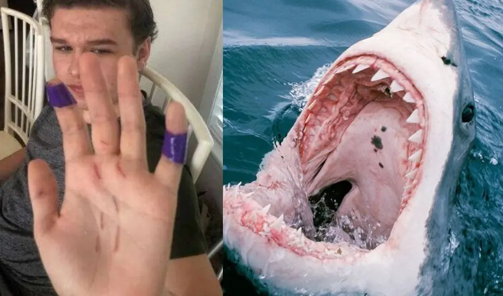 Nick sufrió heridas en su pierna y brazo tras el ataque del tiburón. Foto: Arthur Family / FOX8 Nick sufrió heridas en su pierna y brazo tras el ataque del tiburón. Foto: Arthur Family / FOX8