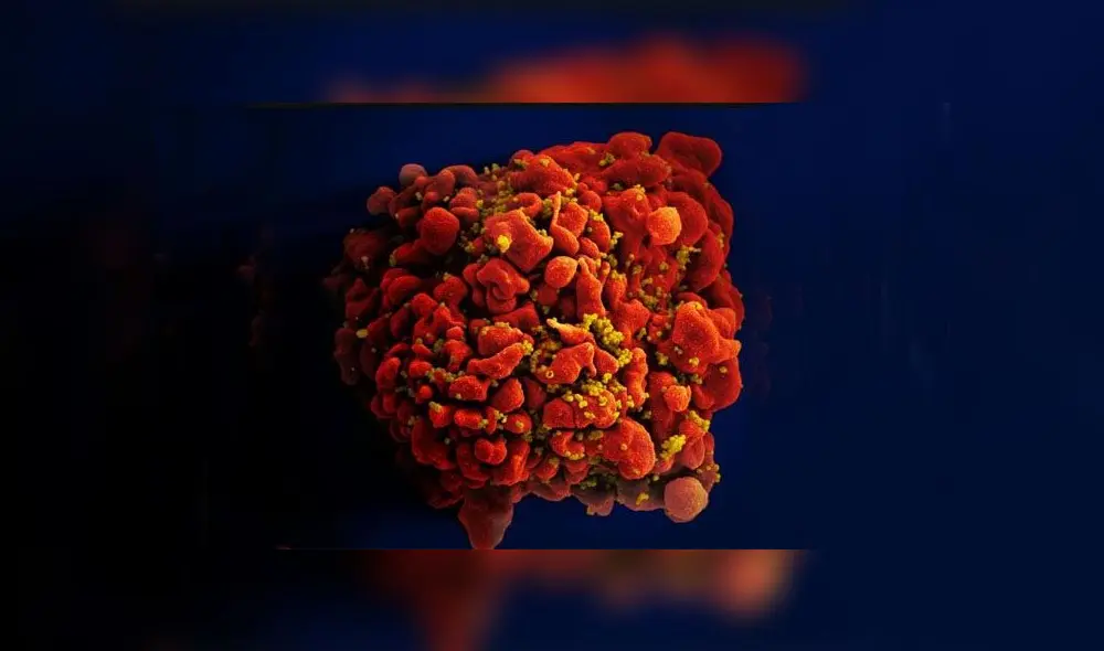 Imagen microscópica de una célula T infectada con VIH. Foto: NIAID