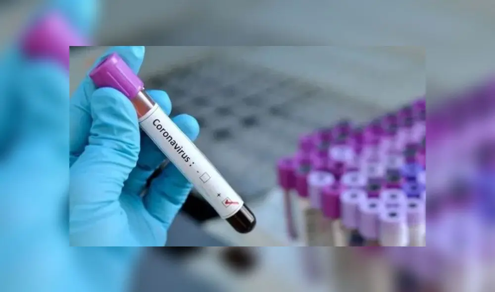 Coronavirus en Perú: ascendió los casos de COVID-19.