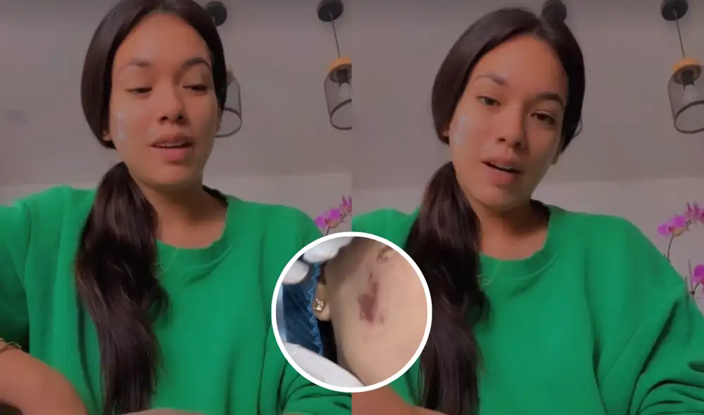 Jazmín Pinedo cuenta cómo se quemó el rostro con una crema. Foto: composición LR/ @jazminpinedo/Instagram