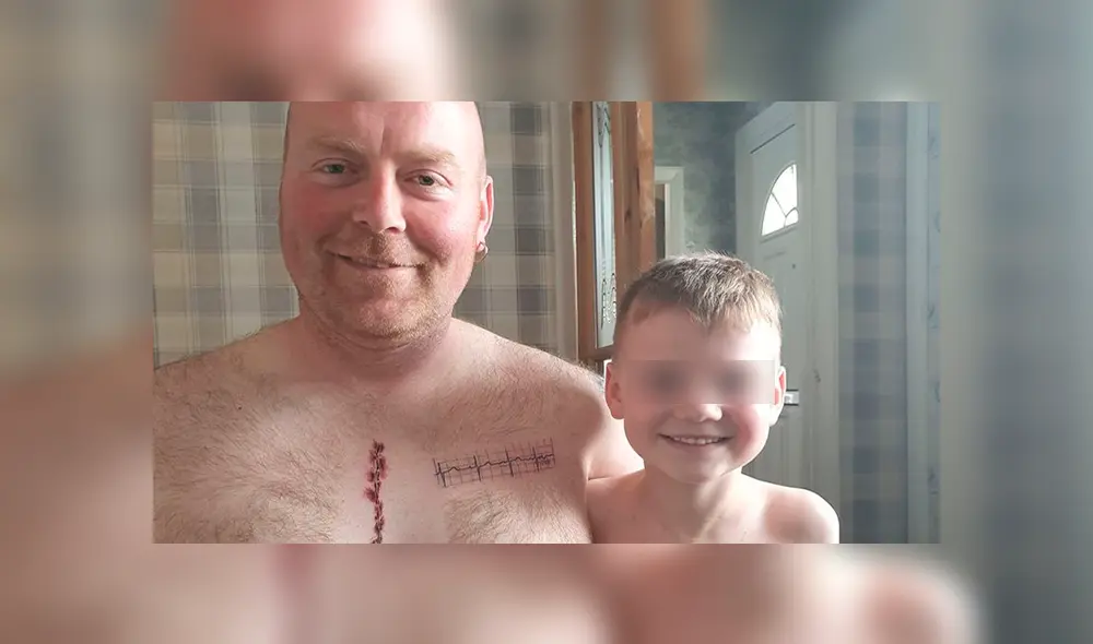 Padre se tatuó cicatriz en solidaridad con su pequeño hijo. Foto: Facebook Padre se tatuó cicatriz en solidaridad con su pequeño hijo. Foto: Facebook